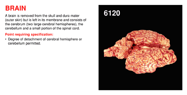 Brain